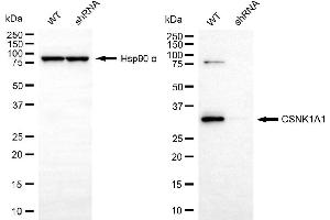 Western blotting analysis using CSNK1A1 antibody (ABIN7797880).