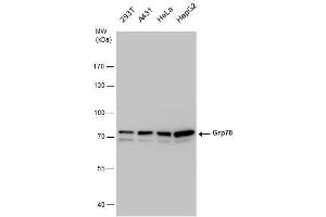 WB Image Grp78 antibody detects Grp78 protein by western blot analysis. (GRP78 anticorps  (Internal Region))