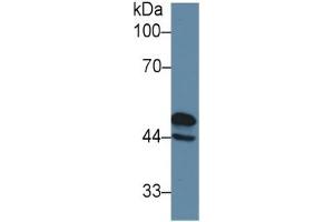 Rabbit Detection antibody from the kit in WB with Positive Control: Sample Rat Cerebrum lysate.