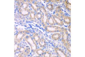 Immunohistochemistry of paraffin-embedded rat kidney using ALDH1A2 antibody at dilution of 1:100 (x400 lens).
