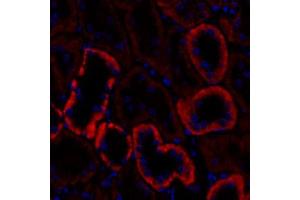 Immunofluorescent analysis of paraformaldehyde-fixed rat kidney using,Cadherin 16 (ABIN7073265) at dilution of 1: 1000