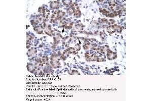Human Pancreas (MYF6 anticorps  (N-Term))