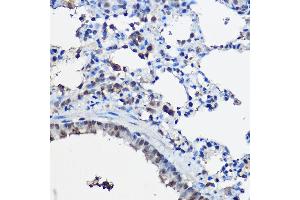 Immunohistochemistry of paraffin-embedded rat lung using [KO Validated] NCO Rabbit pAb (ABIN6129656, ABIN6144413, ABIN6144414 and ABIN7101354) at dilution of 1:100 (40x lens).