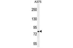 CB086 Antibody (C-term) western blot analysis in A375 cell line lysates (35µg/lane). (WDPCP anticorps  (C-Term))