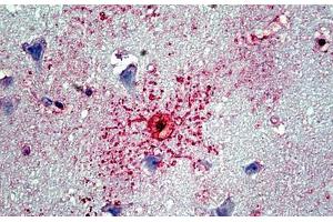 Human Cortex: Formalin-Fixed, Paraffin-Embedded (FFPE)