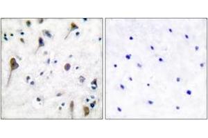 Immunohistochemistry analysis of paraffin-embedded human brain, using PYK2 (Phospho-Tyr580) Antibody. (PTK2B anticorps  (pTyr580))