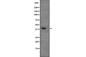 Western blot analysis of EIF2B2 expression in A431 whole cell lysate ,The lane on the left is treated with the antigen-specific peptide.