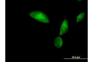 Immunofluorescence of purified MaxPab antibody to TMOD3 on HeLa cell. (TMOD3 anticorps  (AA 1-352))