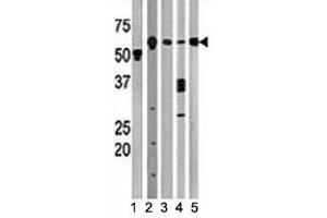 Western blot testing of Beclin antibody and (1) A2058, (2) HeLa, (3) mouse brain, (4) Y79, and (5) HL-60 lysate (Beclin 1 anticorps  (AA 210-239))