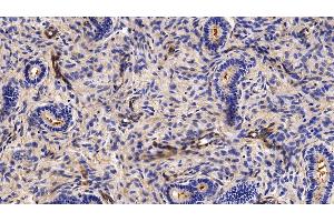 Detection of CAV1 in Porcine Uterus Tissue using Polyclonal Antibody to Caveolin 1 (CAV1)