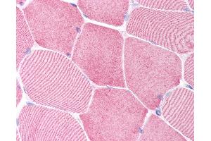 Anti-Caspase 6 antibody IHC of human skeletal muscle. (Caspase 6 anticorps  (N-Term))