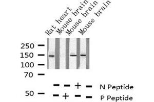 Western blot analysis of Phospho-Met (Tyr1349) expression in various lysates (c-MET anticorps  (pTyr1349))