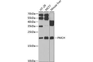 Western blot analysis of extracts of various cell lines, using PMCH antibody (ABIN6130564, ABIN6145812, ABIN6145813 and ABIN6222401) at 1:1000 dilution. (PMCH anticorps  (AA 22-165))