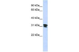 WB Suggested Anti-RNF182 Antibody Titration:  0.