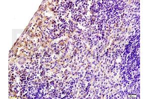 Formalin-fixed and paraffin embedded rat spleen tissue labeled with Anti-CD97 Polyclonal Antibody, Unconjugated at 1:200 followed by conjugation to the secondary antibody, (SP-0023), and DAB staining