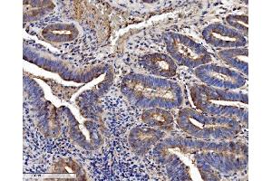 IHC analysis of SEC14L3/TAP2 using anti-SEC14L3/TAP2 antibody (ABIN7601623). (SEC14L3 anticorps  (AA 4-400))