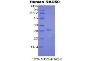 SDS-PAGE analysis of Human RAD50 Protein.