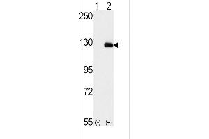 Western blot analysis of BUB1B (arrow) using rabbit polyclonal BUB1B Antibody (N-term) (ABIN392627 and ABIN2842137). (BUB1B anticorps  (N-Term))