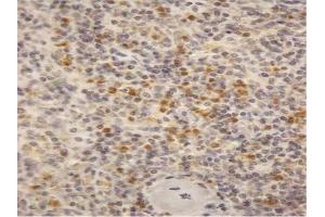 AP23688PU-N (2µg/ml) staining of paraffin embedded Human Spleen. (CYBB anticorps  (Internal Region))
