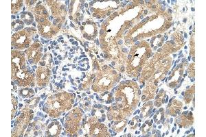 ADAMTS4 antibody was used for immunohistochemistry at a concentration of 4-8 ug/ml to stain Epithelial cells of renal tubule (arrows) in Human Kidney.