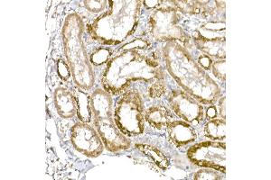 Immunohistochemistry of paraffin-embedded rat kidney using GC1q R/C1QBP antibody (ABIN7266473) at dilution of 1:25 (40x lens).