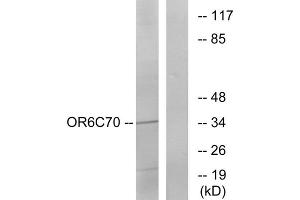 Western blot analysis of extracts from Jurkat cells, using OR6C70 antibody. (OR6C70 anticorps  (C-Term))