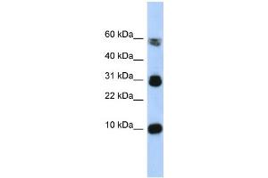 WB Suggested Anti-FABP4 Antibody Titration:  0.