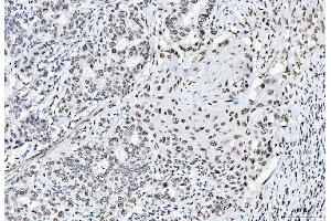 IHC analysis of CTBP2 using anti-CTBP2 antibody (ABIN7601325). (CTBP2 anticorps  (AA 321-445))