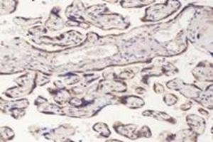 Immunohistochemistry analysis of paraffin-embedded human placenta using,PFDN4 (ABIN7075171) at dilution of 1: 4200 (PFDN4 anticorps)