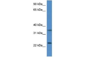 WB Suggested Anti-Cyb5r1 Antibody   Titration: 1. (CYB5R1 anticorps  (N-Term))