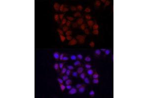 Immunofluorescence analysis of HeLa cells using YAP1 antibody.