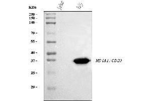 Western blot analysis of CD20 using anti-CD20 antibody (ABIN7599180).