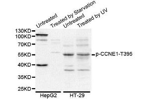 Western blot analysis of extracts of various cell lines, using Phospho-CCNE1-T395 antibody (ABIN5969875). (Cyclin E1 anticorps  (pThr395))