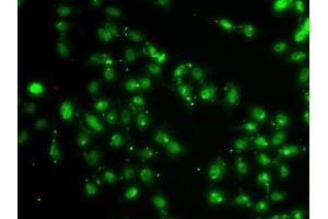 Immunofluorescence analysis of A549 cell using L3MBTL1 antibody. (L3MBTL1 anticorps)