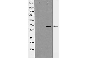 Western blot analysis of Cyclin E2 expression in COLO cells.