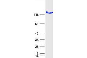Validation with Western Blot