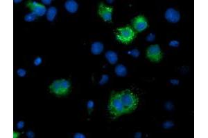 Immunofluorescence (IF) image for anti-IlvB (Bacterial Acetolactate Synthase)-Like (ILVBL) antibody (ABIN1498879) (ILVBL anticorps)