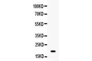Western blot analysis of GADD45A expression in MCF-7 whole cell lysates ( Lane 1). (GADD45A anticorps  (C-Term))