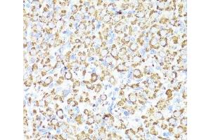 Immunohistochemistry of paraffin-embedded Rat ovary using CYP3A4 Polyclonal Antibody at dilution of 1:100 (40x lens). (CYP3A4 anticorps)