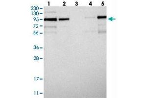 Western blot analysis of Lane 1: RT-4, Lane 2: U-251 MG, Lane 3: Human Plasma, Lane 4: Liver, Lane 5: Tonsil with LRCH1 polyclonal antibody  at 1:250-1:500 dilution. (LRCH1 anticorps)