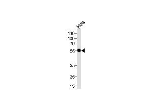 Western blot analysis of lysate from Hela cell line, using DDX6 Antibody at 1:1000 at each lane. (DDX6 anticorps  (C-Term))