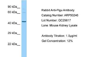 Western Blotting (WB) image for anti-Phosphatidylinositol Glycan Anchor Biosynthesis, Class U (PIGU) (N-Term) antibody (ABIN2784115) (PIGU anticorps  (N-Term))