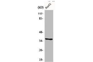 Western Blot analysis of LOVO cells using CA VI Polyclonal Antibody (CA6 anticorps  (C-Term))