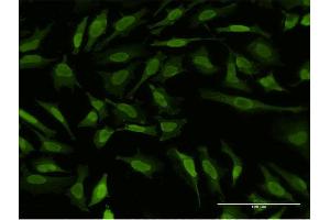 Immunofluorescence of monoclonal antibody to RPS6KA5 on HeLa cell.