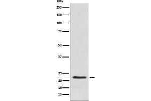Western blot analysis of Placental lactogen expression in Human placenta lysate.