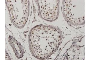 Image no. 3 for anti-Interferon Regulatory Factor 5 (IRF5) antibody (ABIN6745988) (IRF5 anticorps)