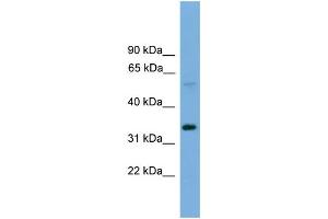 WB Suggested Anti-TM7SF4  Antibody Titration: 0. (Transmembrane 7 Superfamily Member 4 (TM7SF4) (N-Term) anticorps)