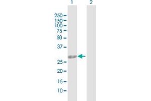Western Blot analysis of AK2 expression in transfected 293T cell line by AK2 MaxPab polyclonal antibody.