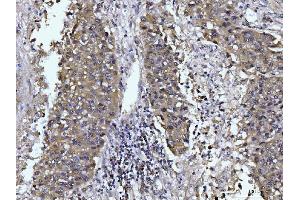 IHC analysis of Glutaminase/GLS using anti-Glutaminase/GLS antibody (ABIN7601601). (Glutaminase anticorps  (AA 396-654))