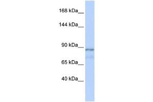 WB Suggested Anti-ZFAT1 Antibody Titration:  0. (ZFAT anticorps  (Middle Region))